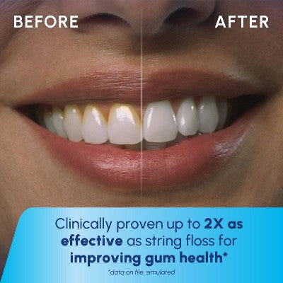 Waterpik Cordless Water Flosser - Imperfect Box